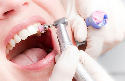 Ультразвуковая чистка зубов: особенности и преимущества