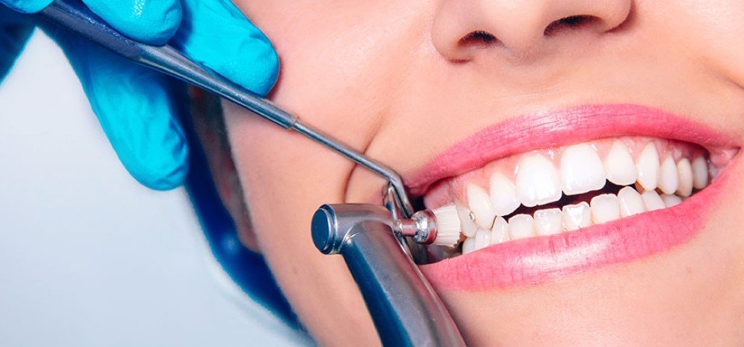 Ультразвуковая чистка зубов: особенности и преимущества